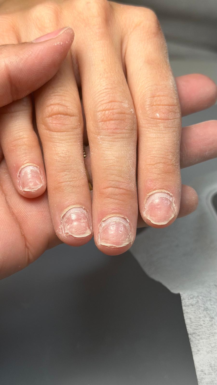 Nail Restoration with IBX by Keny Rohr